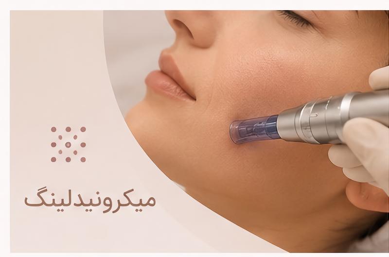 میکرونیدلینگ