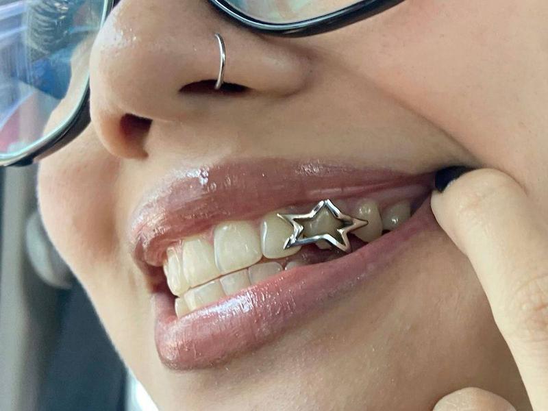 گریلز دندون ستاره ای 