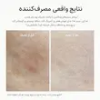 تصویر قبل و بعد استفاده از Arencia