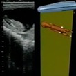 فیلم آموزشی تشخیص آبستنی و سن و جنسیت جنین در گاو و اسب با سونوگرافی