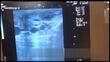 فیلم های آموزشی تشخیص آبستنی و سن جنین در گاو با سونوگرافی