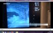 فیلم های آموزشی تشخیص آبستنی و سن جنین در گاو با سونوگرافی