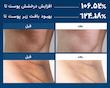 تاثیر استفاده از اسپری پیل شات لایه‌بردار و روشن‌کننده دکتر ملاکسین Dr.Melaxin مدل EXFOLIATING TX-SPRAY