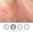 کرم ترمیم‌کننده 345 ریلیف دکتر آلتیا | Dr. Althea 345 Relief Cream